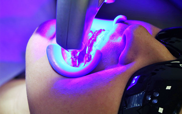 Tratamento com laserterapia na Zona Norte de SP