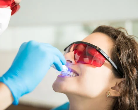 Clareamento Dental
