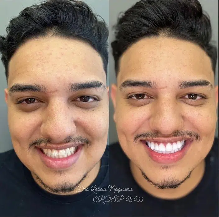Tratamento Clínica Odonto Nobre1