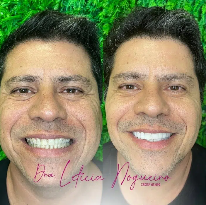Tratamento Clínica Odonto Nobre2