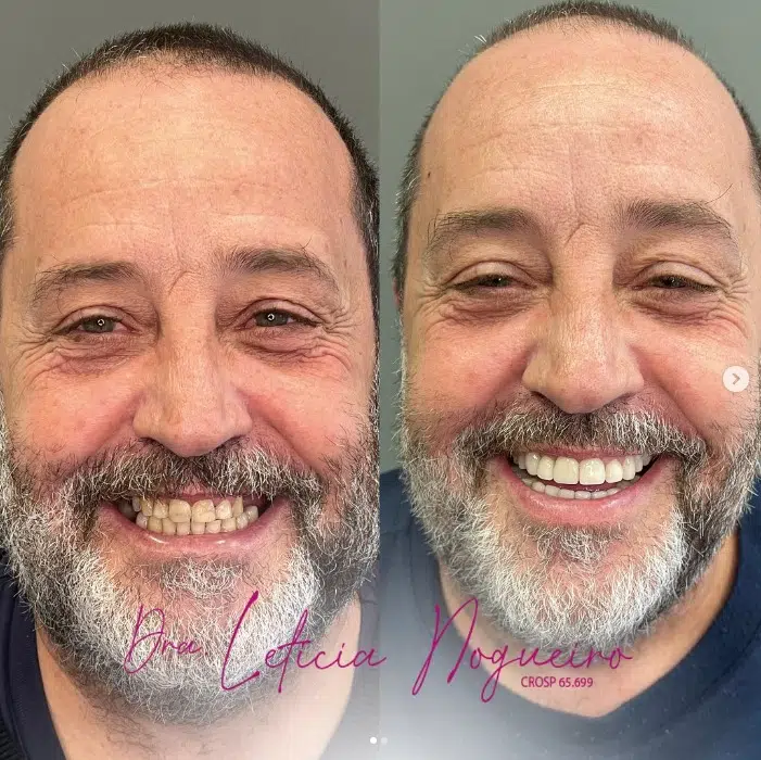 Tratamento Clínica Odonto Nobre3